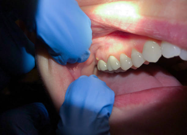 Best Weekend Emergency Dentist in Flat Rock, MI