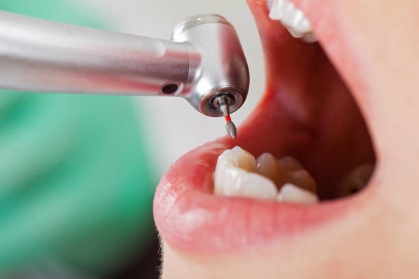 Best Emergency Dental Care for Abscessed Tooth in Flat Rock, MI